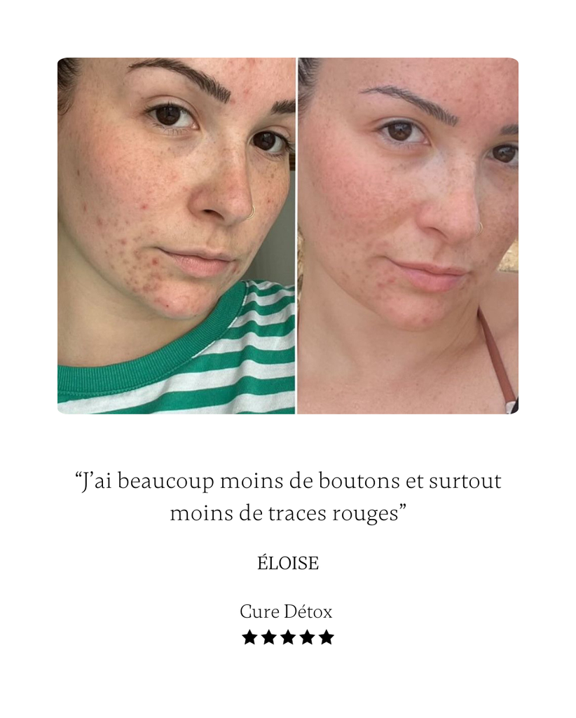 PEAU - DETOX DRAINANT image 1