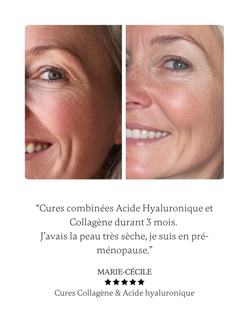 PEAU - ACIDE HYALURONIQUE image 1